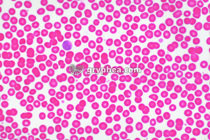 Sang de mouton, frottis HE x200 - gryphea.com